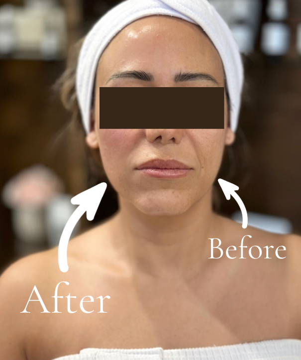 Before and after results of manual lymphatic drainage facial showing visibly lifted, toned, and sculpted skin using holistic techniques at Cecilia Berkley Holistic Spa.